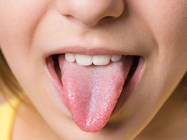 「舌の位置」、把握していますか？