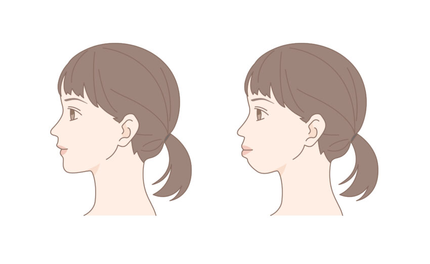 有村藍里さんの整形手術の報道をうけて感じたこと