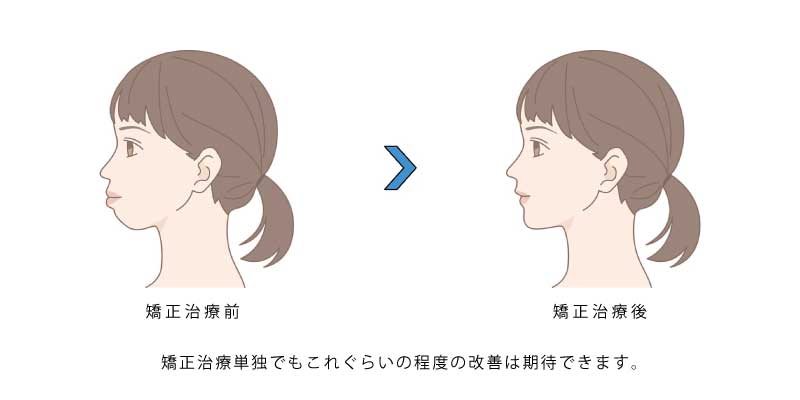 有村藍里さんの整形手術の報道をうけて感じたこと